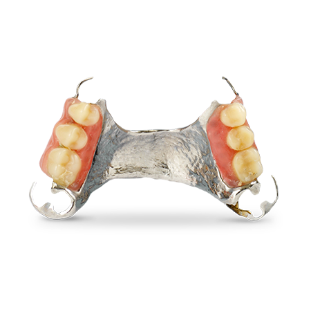 cast part